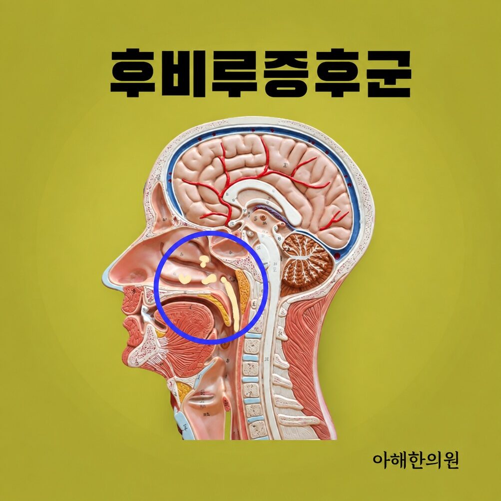 영통 비염후비루, 감기 후 가래 느낌이 계속된다면